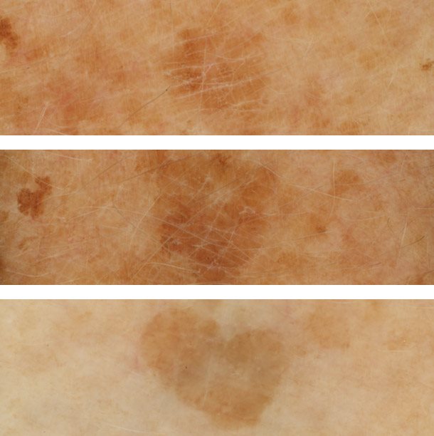 Eucerin EVEN BRIGHTER Day Cream Hyperpigmentation